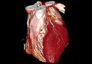 diag_seitenwandarterie01.jpg