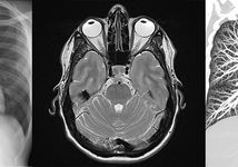 Ab jetzt können Sie Ihre Untersuchungsbilder online einsehen